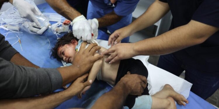 A Palestinian girl, wounded in an Israeli strike on a camp for displaced Gazans, receives treatment at a hospital in Rafah on May 26, 2024, amid the ongoing conflict between Israel and the militant group Hamas. (Photo by Eyad BABA / AFP)